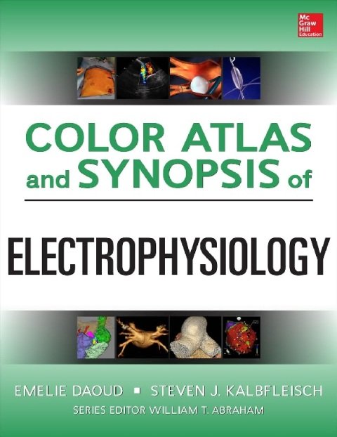Color Atlas and Synopsis of Electrophysiology.