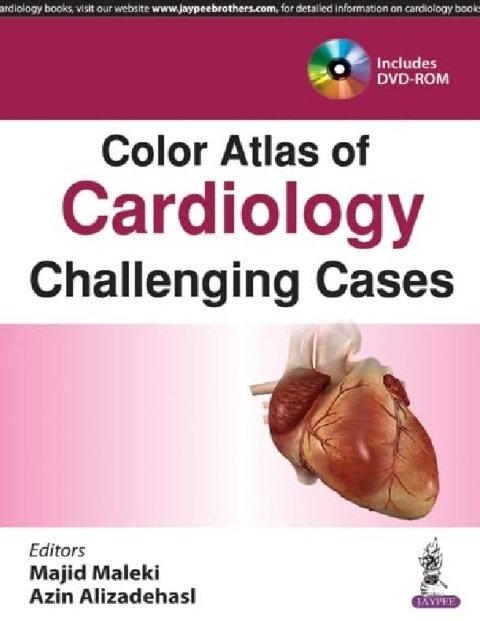 Color Atlas of Cardiology Challenging Cases.