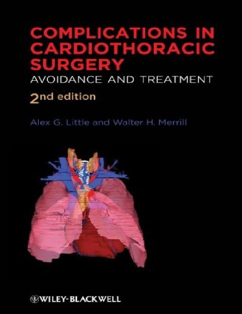 Complications in Cardiothoracic Surgery Avoidance and Treatment.