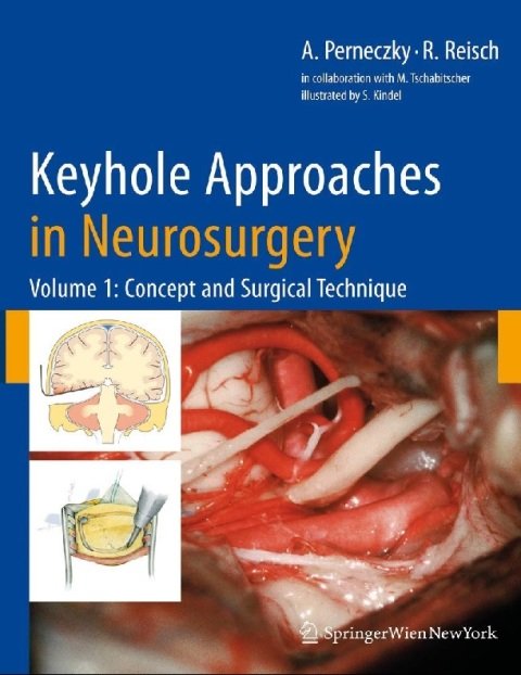Concept and Surgical Technique (Volume 1) (Key Hole Approaches in Neurosurgery).