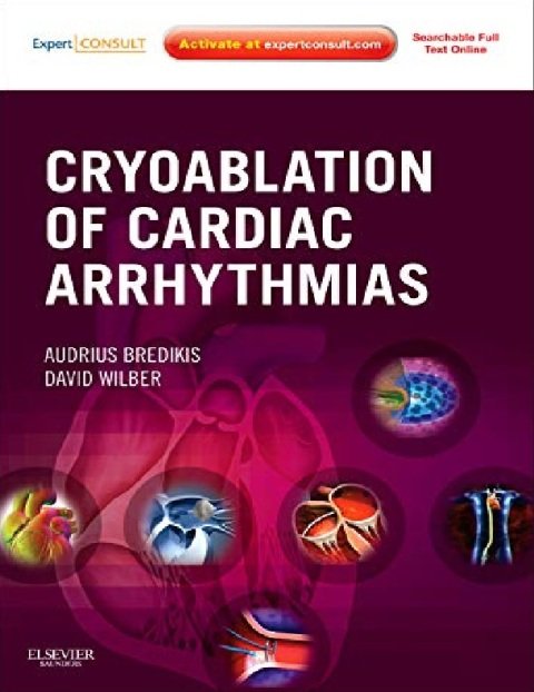 Cryoablation of Cardiac Arrhythmias.