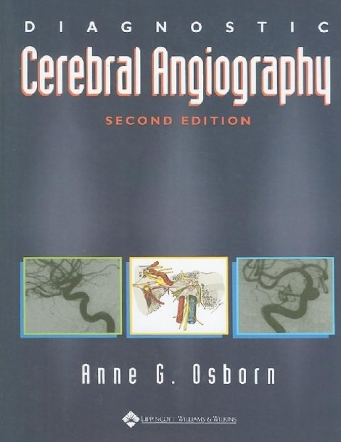 Diagnostic Cerebral Angiography.