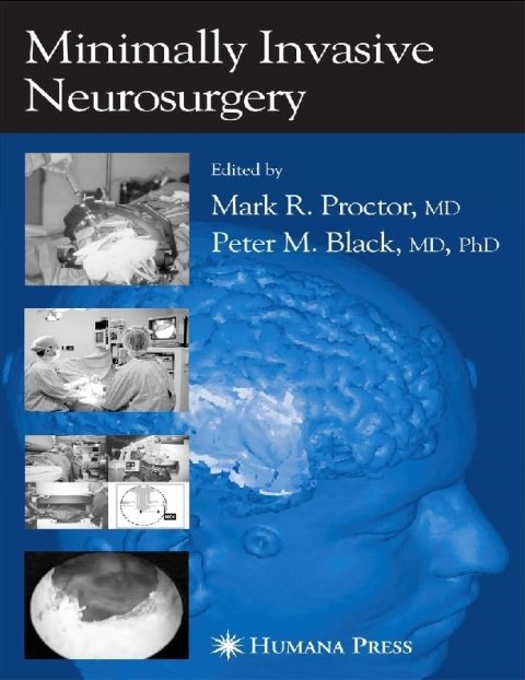 Minimally Invasive Neurosurgery.