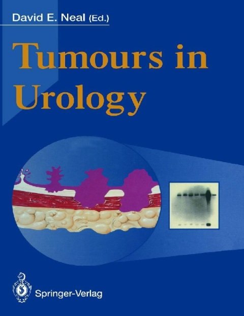 Tumours in Urology.