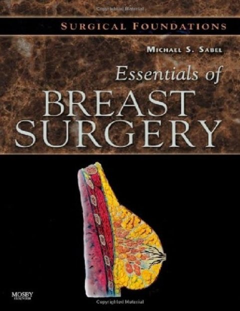 Essentials of Breast Surgery A Volume in the Surgical Foundations Series.