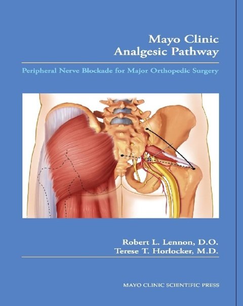 Mayo Clinic Analgesic Pathway Peripheral Nerve Blockade for Major Orthopedic Surgery.