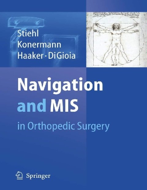 Navigation and MIS in Orthopedic Surgery.