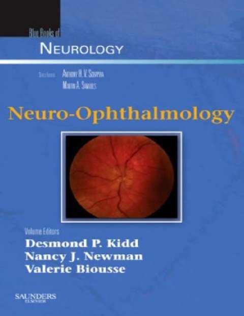 Neuro-Ophthalmology (Blue Books of Neurology Series, Vol. 32) (Volume 32).