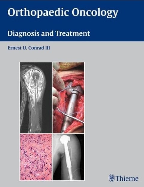 Orthopaedic Oncology Diagnosis and Treatment.