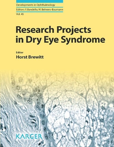 Research Projects in Dry Eye Syndrome (Developments in Ophthalmology Book 45).