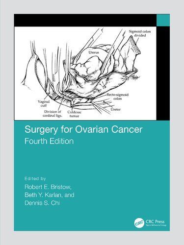 Surgery-for-Ovarian-Cancer-4th-Edition