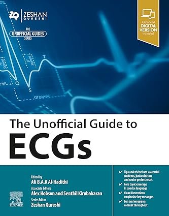 The Unofficial Guide to ECGs: The Unofficial Guide to ECGs (Unofficial Guides)