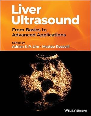 Liver Ultrasound: From Basics to Advanced Applications 1st Edition