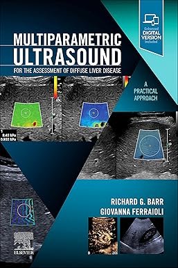 Multiparametric Ultrasound for the Assessment of Diffuse Liver Disease: A Practical Approach