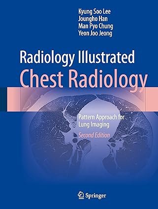 Radiology Illustrated: Chest Radiology: Pattern Approach for Lung Imaging 2nd ed.