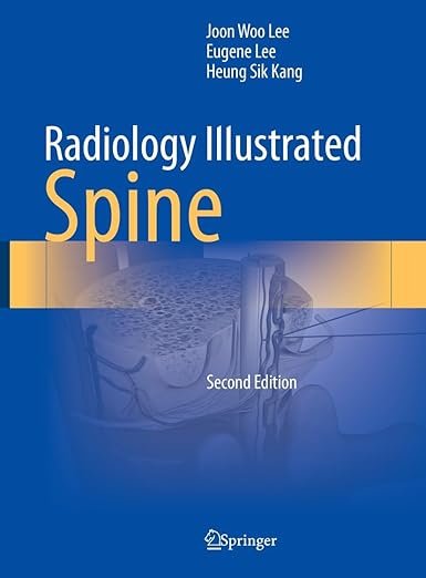 Radiology Illustrated: Spine 2nd Edition