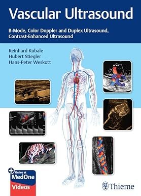 Vascular Ultrasound: B-Mode, Color Doppler and Duplex Ultrasound, Contrast-Enhanced Ultrasound 1st Edition