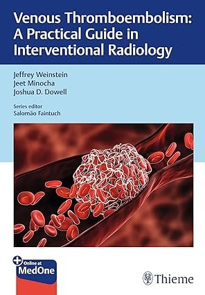 Venous Thromboembolism: A Practical Guide in Interventional Radiology