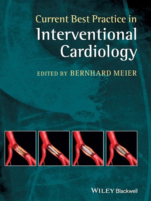 Current Best Practice in Interventional Cardiology 1st Edition