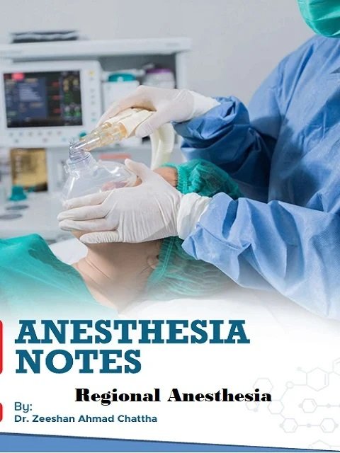 Anesthesia Notes Regional Anesthesia