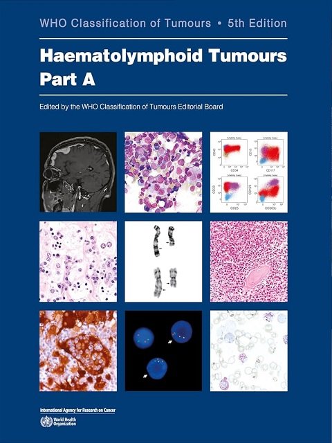 Haematolymphoid Tumours WHO Classification of Tumours