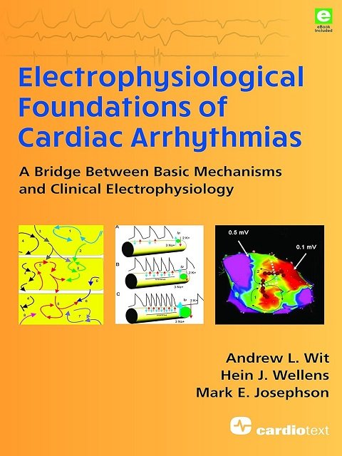 Electrophysiological Foundations of Cardiac Arrhythmias: A Bridge Between Basic Mechanisms and Clinical Electrophysiology 1st Edition