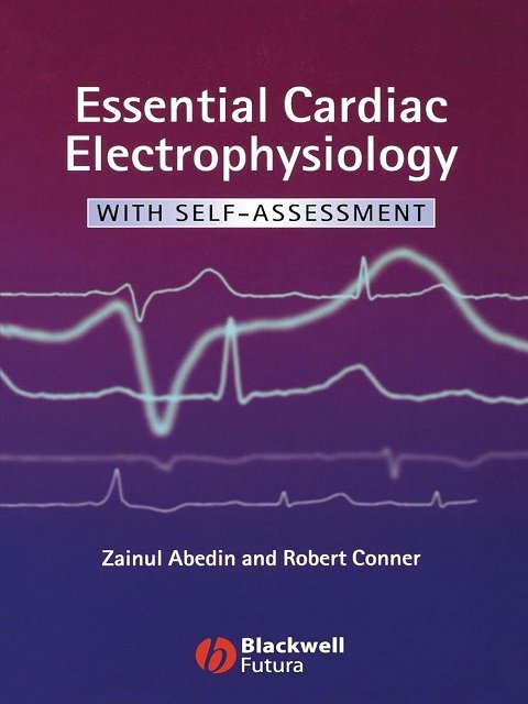 Essential Cardiac Electrophysiology: With Self–Assessment