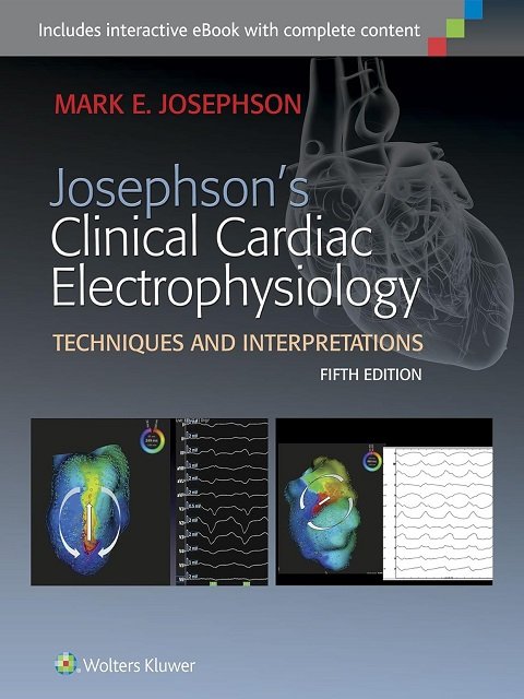 Josephson's Clinical Cardiac Electrophysiology Fifth Edition