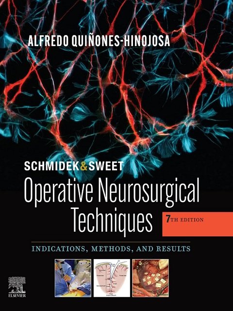 Schmidek and Sweet Operative Neurosurgical Techniques Indications, Methods and Results