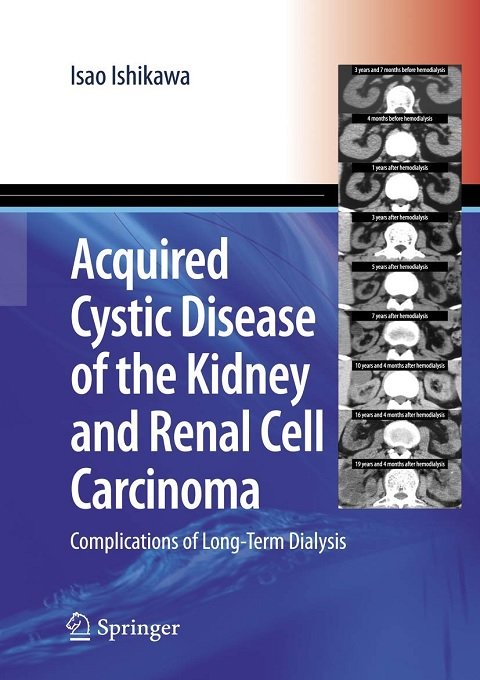 Acquired Cystic Disease of the Kidney and Renal Cell Carcinoma Complication of Long-Term Dialysis