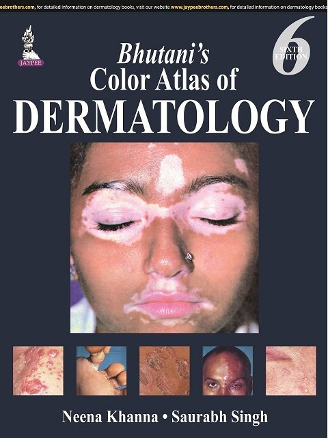 Bhutani's Color Atlas of Dermatology