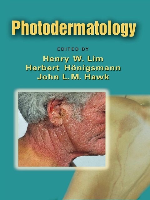 Photodermatology (Basic and Clinical Dermatology, 38)