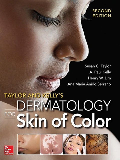 Taylor and Kelly's Dermatology for Skin of Color 2E
