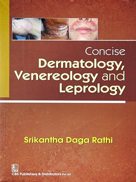 Concise Dermatology, Venereology and Leprology