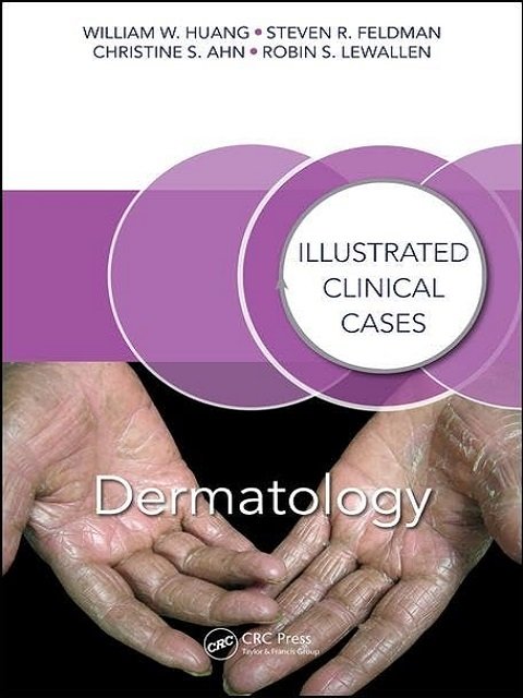 Dermatology Illustrated Clinical Cases
