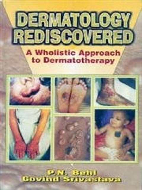 Dermatology Rediscovered A Wholistic Approach to Dermato-Therapy