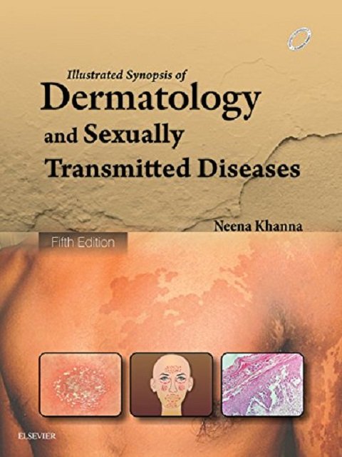 Illustrated Synopsis of Dermatology & Sexually Transmitted Diseases