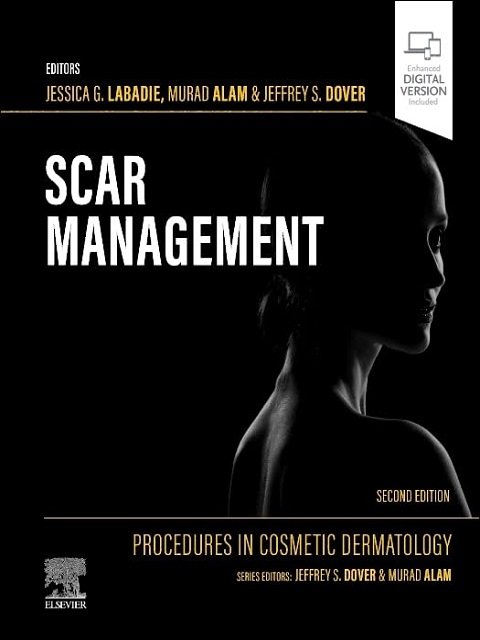 Procedures in Cosmetic Dermatology Scar Management
