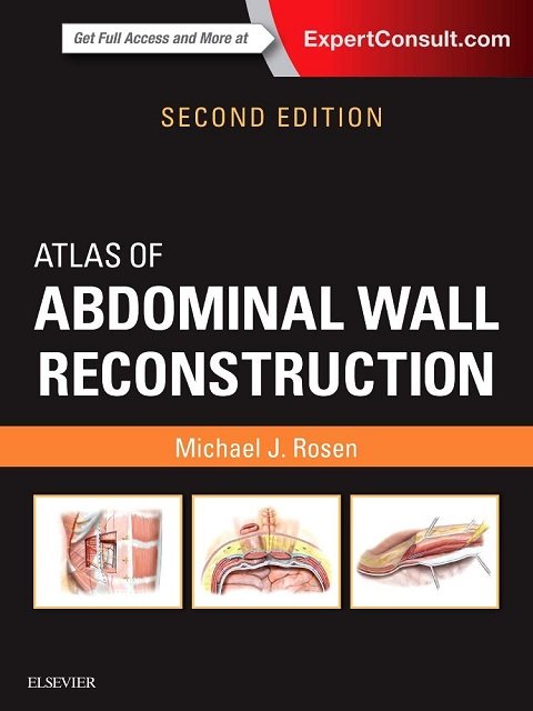 Atlas of Abdominal Wall Reconstructio 2nd Edition