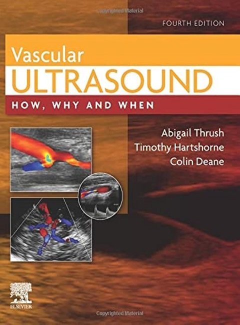 Vascular Ultrasound How, Why and When