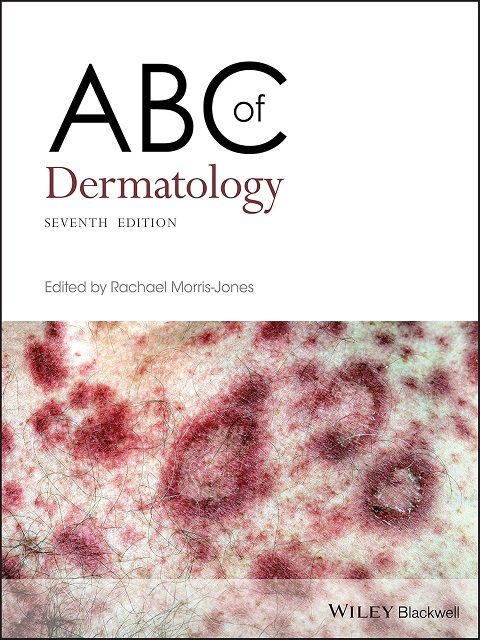 ABC of Dermatology (ABC Series)