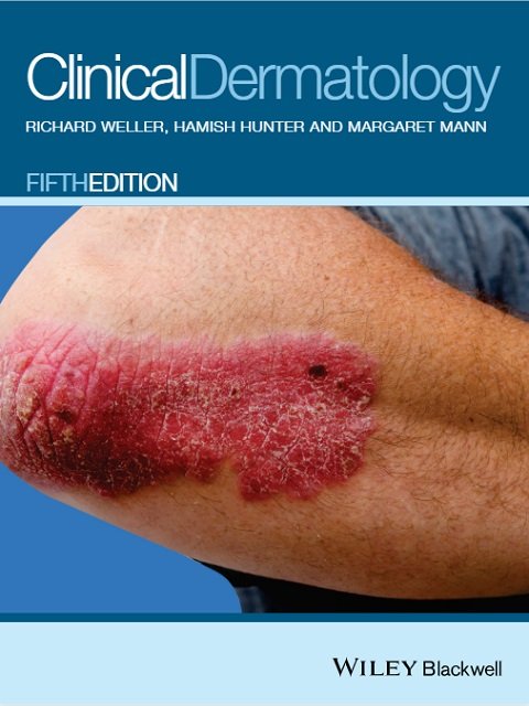 Clinical Dermatology 5th Edition