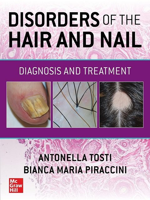 Disorders of the Hair and Nail Diagnosis and Treatment