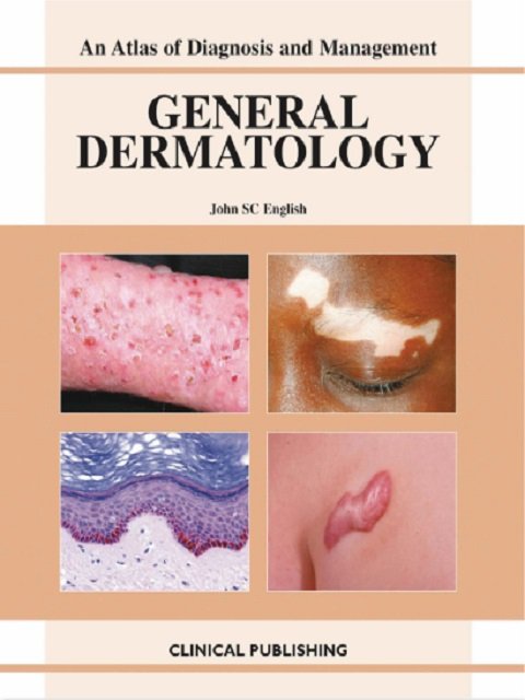 General Dermatology (Atlas of Investigation and Management)