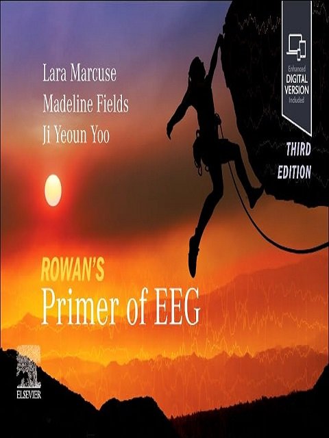 Rowan's Primer of EEG