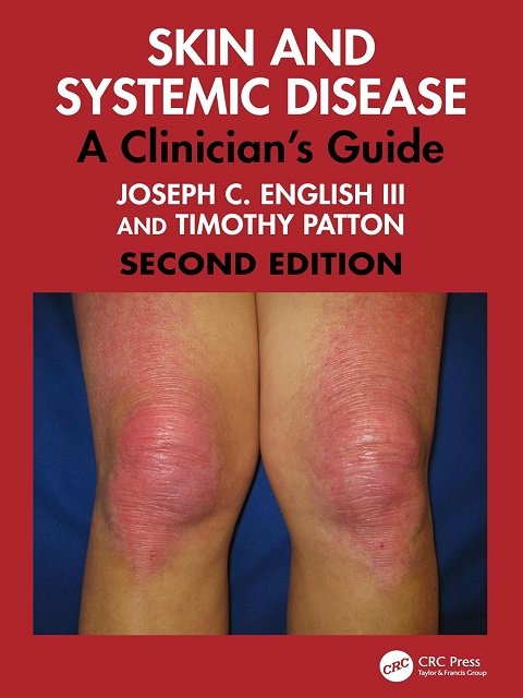 Skin and Systemic Disease A Clinician's Guide