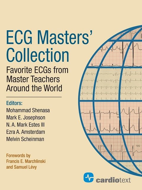 ECG Masters Collection Favorite ECGs from Around the World 1st Edition