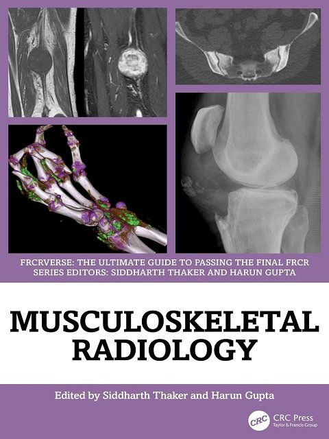 Musculoskeletal Radiology An Ultimate Guide to Passing the Final FRCR (FRCRverse)