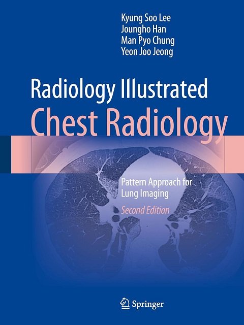 Radiology Illustrated Chest Radiology Pattern Approach for Lung Imaging