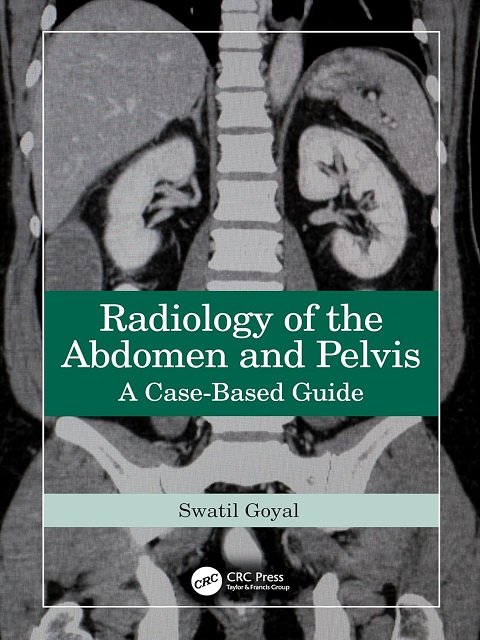 Radiology of the Abdomen and Pelvis A Case-Based Guide